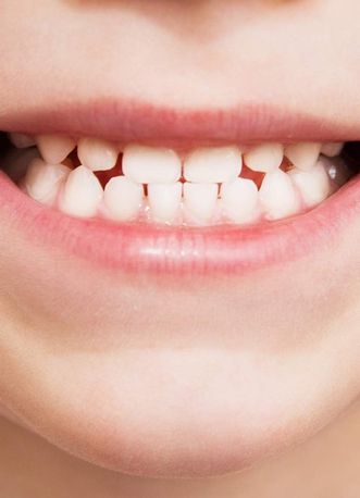 Почему стоматологи называют зубы по номерам?